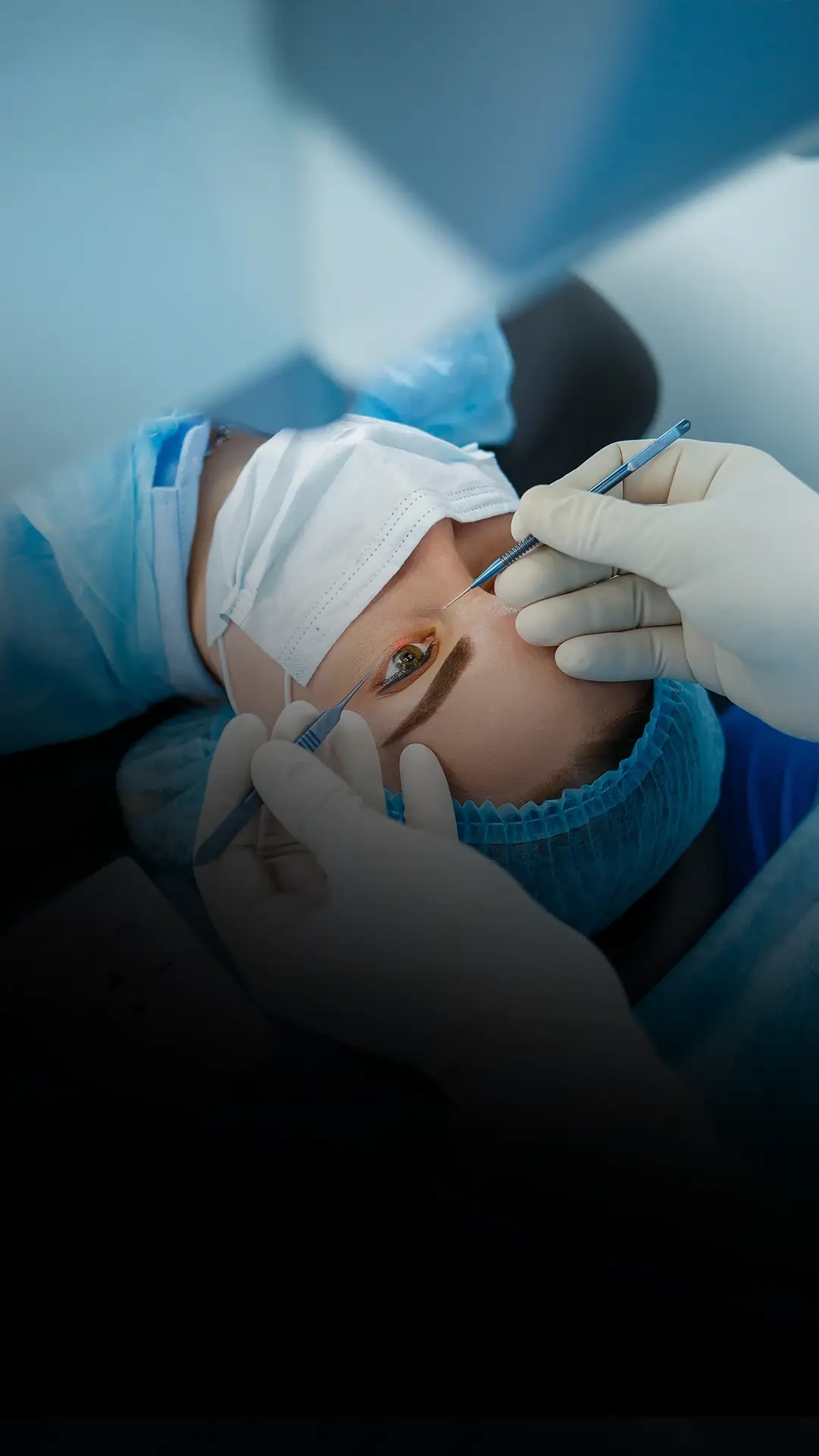 Cirurgia de Glaucoma uai