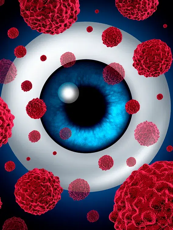 06 Especialidades Medicas Oncologia Ocular