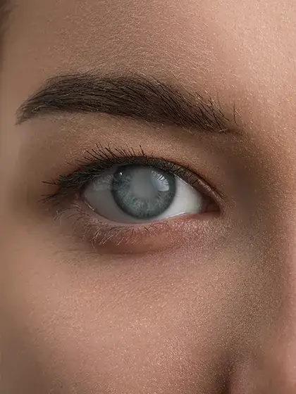 Glaucoma Banner celular uai