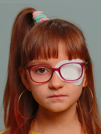 Glaucomo congenito uai