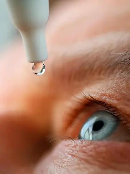 Neuro Oftalmologia colirio uai