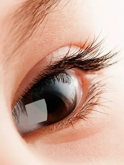 Oftalmologia Pediatrica Retinopatia da Prematuridade uai