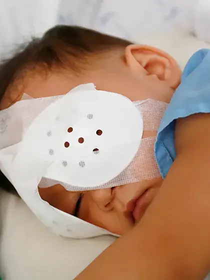 Oftalmologia Pediatrica cirurgia ocular infantil uai