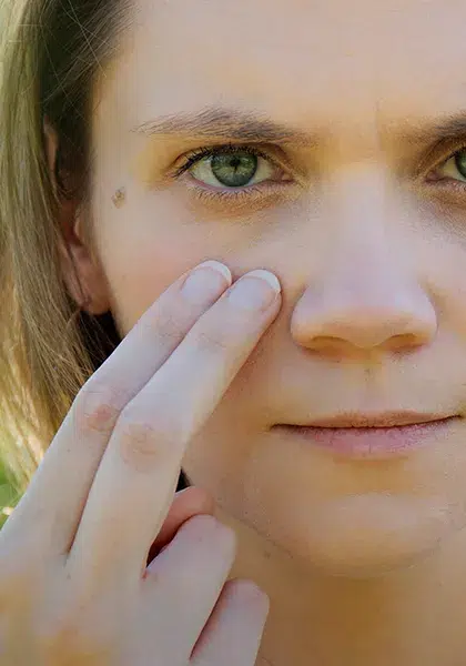 Paralisias Oculomotoras