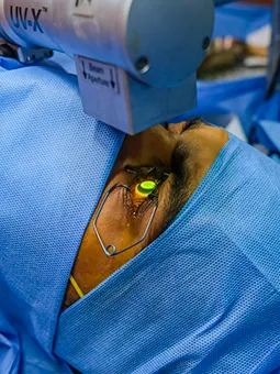 Tratamento de corne Crosslinking Corneano