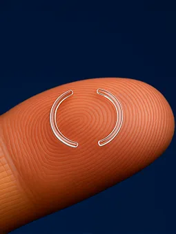 Tratamento de corne Implante de Anel Corneano