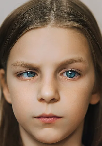 01 Cirurgias de estrabismor