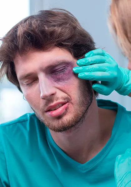 04 Cirurgia de Catarata Traumas oculares