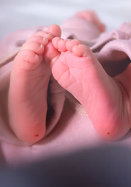 05 Cirurgia de Catarata Doencas congenitas