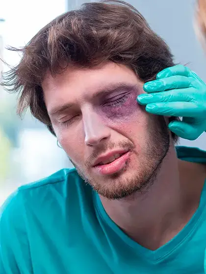 05 emergencia Traumas oculares uai