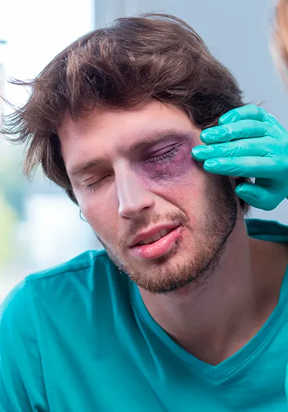 05 emergencia Traumas oculares