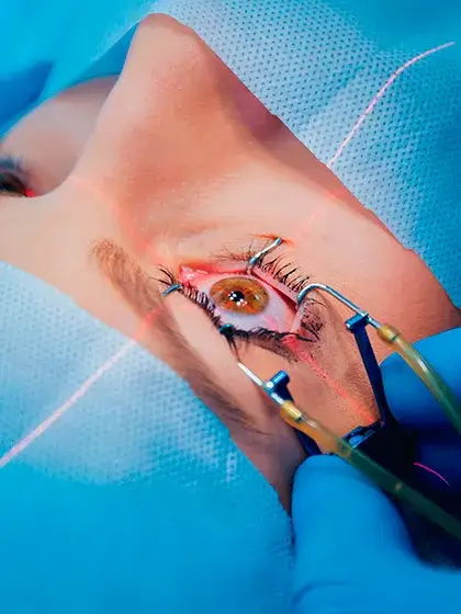 07 RETINA E ViTREO Fotocoagulacao a Laser uai