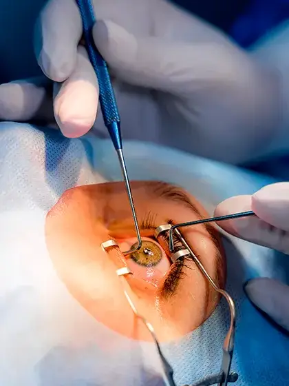 08 RETINA E ViTREO Vitrectomia uai