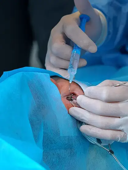 09 Oncologia Ocular quimio terapia uai