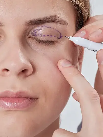 09 Plastica e Vias Lacrimais Obstrucao e Infeccao das Vias Lacrimais uai