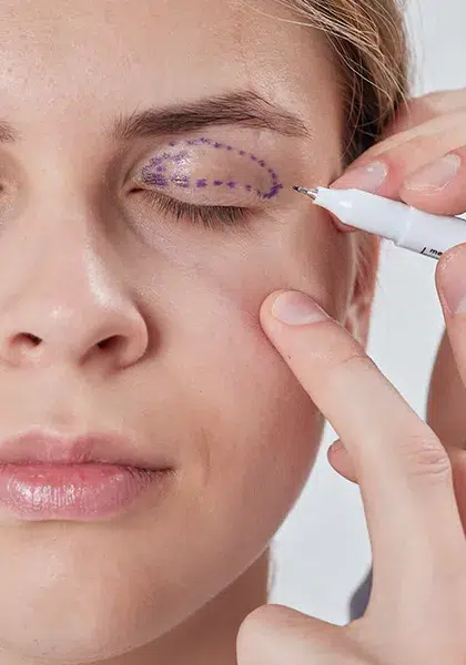 09 Plastica e Vias Lacrimais Obstrucao e Infeccao das Vias Lacrimais