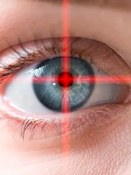 09 RETINA E ViTREO Terapia Fotodinamica uai