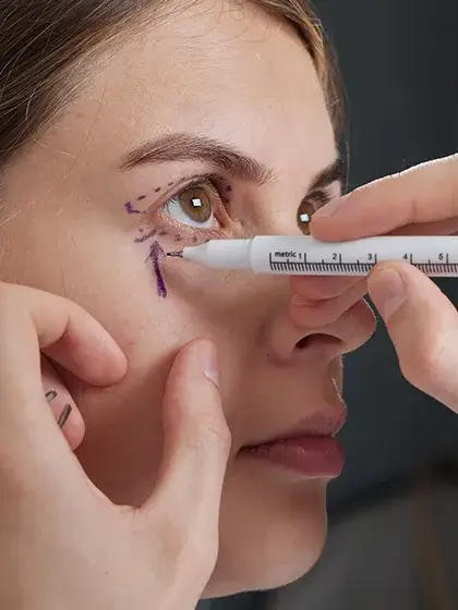 10 Plastica e Vias Lacrimais Blefaroplastia uai