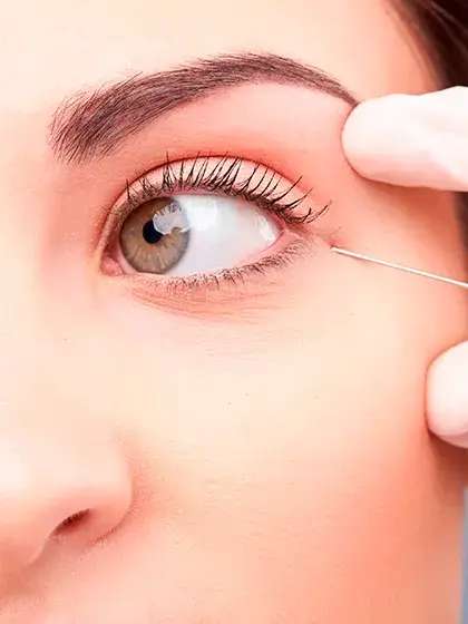 11 Plastica e Vias Lacrimais Tratamento de Blefaroespasmo uai