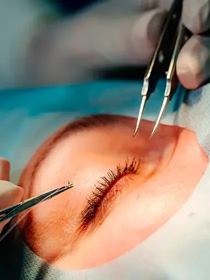 12 Plastica e Vias Lacrimais Cirurgias de Vias Lacrimaiso uai