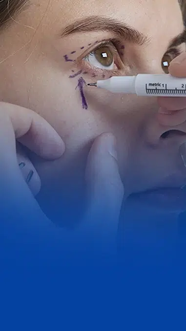 Nova Plastiva Ocular